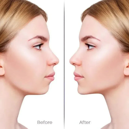 Invisible Face Lifter Tape✨Has a delicate V face